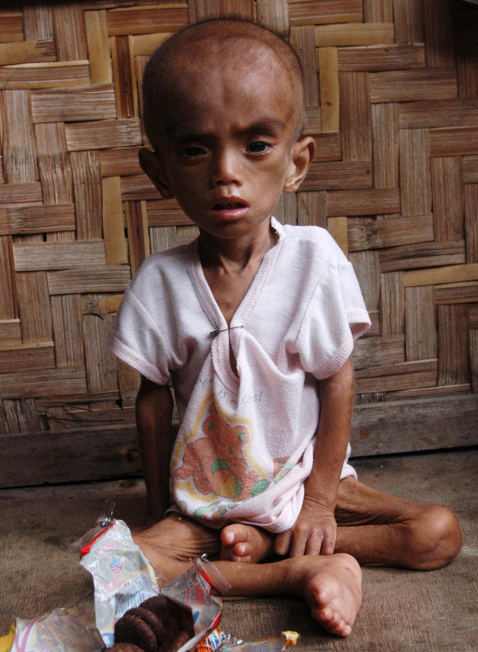 Fotografija: Otroci ne vedo, kdaj in ali sploh bodo dobili naslednji obrok hrane. Mnogi so le še kost in koža. FOTO: Reuters
