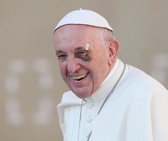 Fotografija: Papež Frančišek se je pred leti poškodoval v papamobilu. FOTO: Youtube