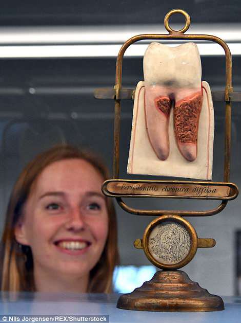 Fotografija: Model obolelega zoba