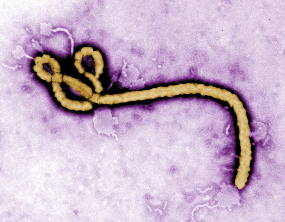 Fotografija: Virus ebole. FOTO: AP