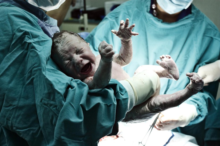 Fotografija: Takoj ob rojstvu sta pomislila, da deklica morda ni njuna. FOTO: Reynardt/Getty Images
