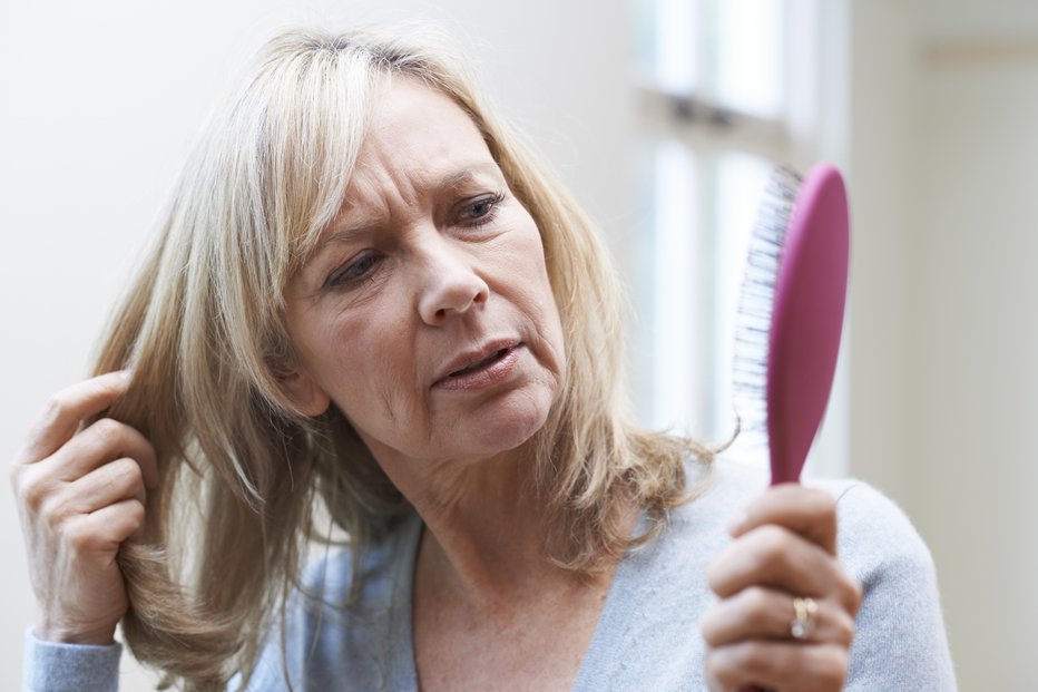 Fotografija: Izpadanje las v menopavzi ni redkost. FOTO: Guliver/Getty Images