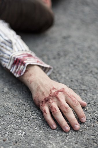 Fotografija: Moški je padel v grmovje (simbolična fotografija). FOTO: Getty Images/istockphoto