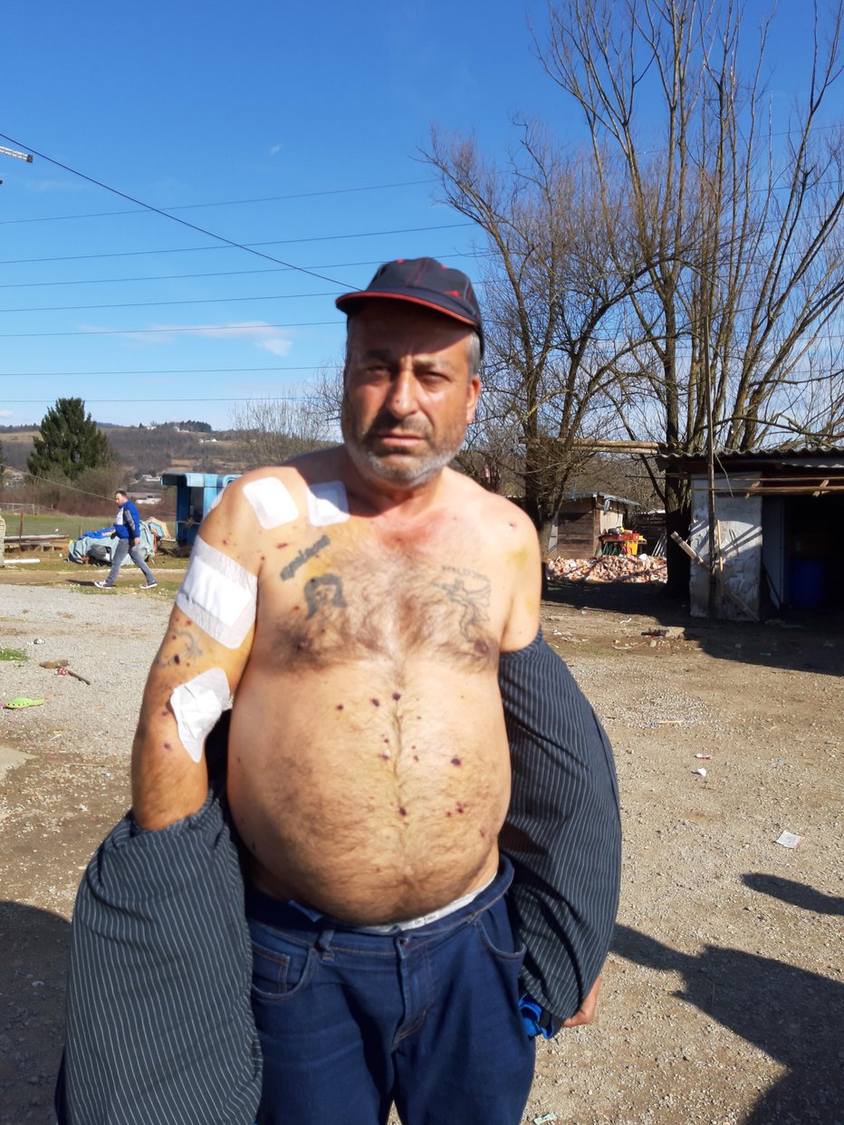 Fotografija: Roman Novak ima poškodbe po vsem telesu FOTO: Tanja Jakše Gazvoda