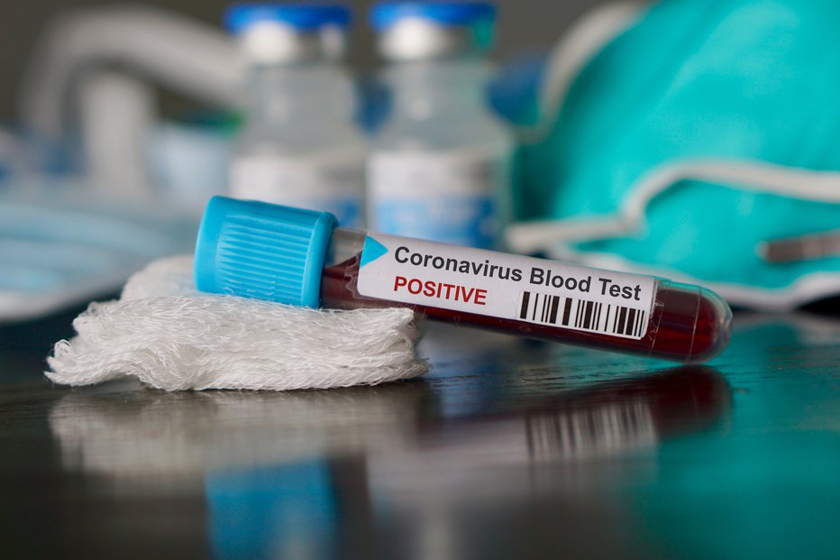 Fotografija: Med osnovnošolci je završalo, da ima eden izmed njih koronavirus. FOTO: Getty Images, Istockphoto
