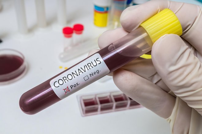 Cepiva za sars-cov-2 še ni, po nekaterih napovedih ga lahko pričakujemo šele v letu dni. FOTO: Getty Images, Istockphoto
