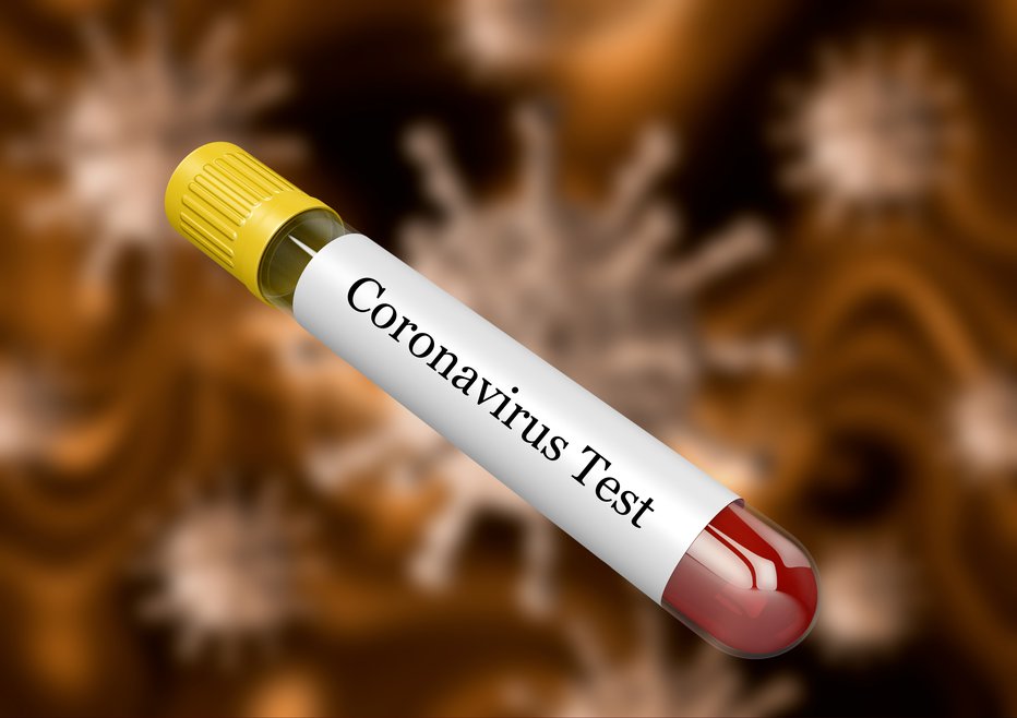 Fotografija: Koronavirus najprej običajno napade pljuča. FOTO: Getty Images, Istockphoto