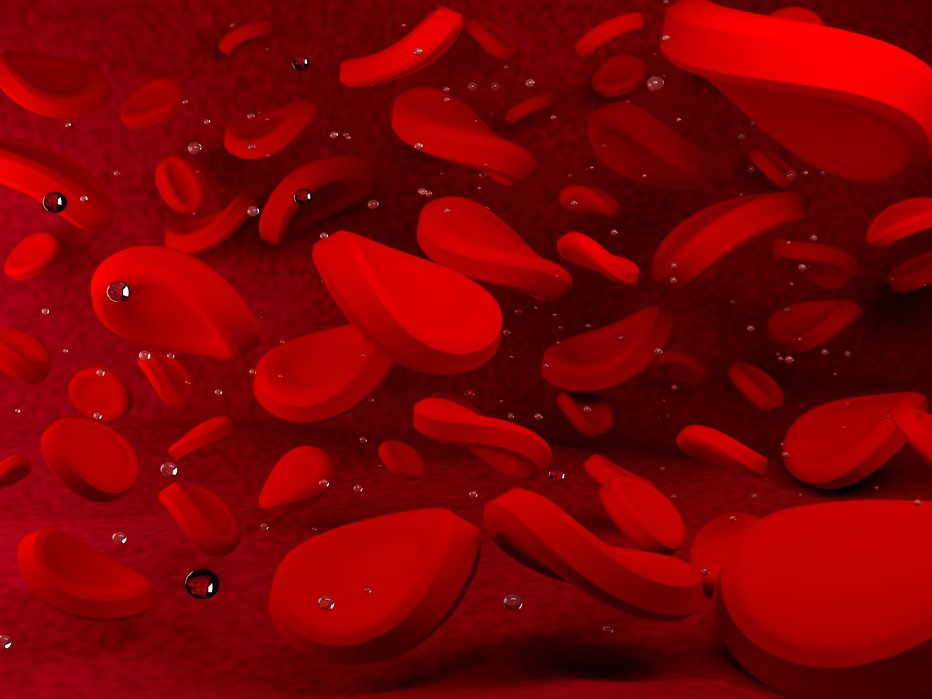 Fotografija: Po svetu je okoli 400.000 ljudi s hemofilijo. FOTOGRAFIJE: Guliver/Getty Images
