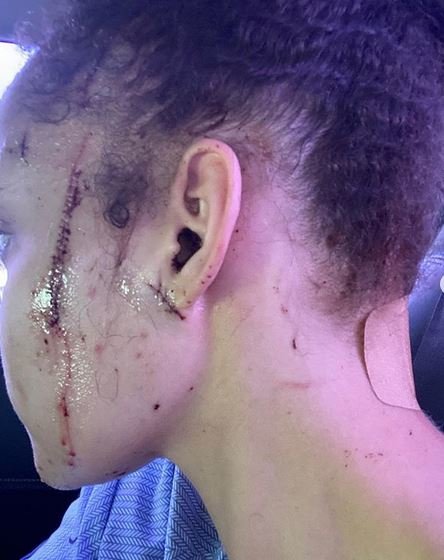 Fotografija: Yasmine Jackson so napadli pred domačim pragom. FOTO: Instagram, posnetek zaslona