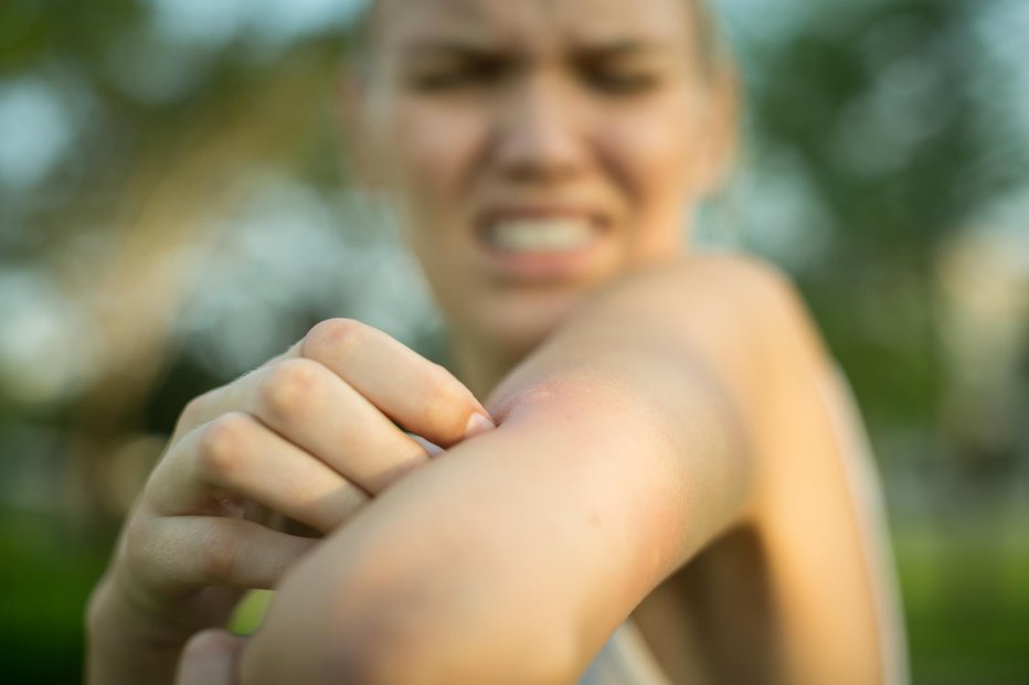Fotografija: Nekateri komarjem prav posebej dišijo.FOTO: Globalmoments, Getty Images