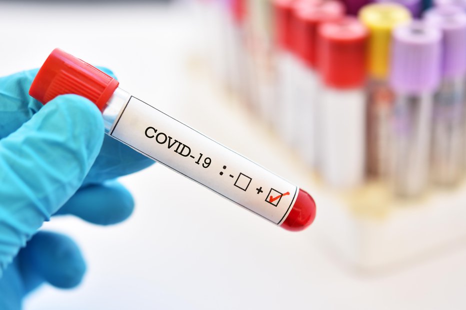 Fotografija: Sloveniji primanjkuje hitrist testov na novi koronavirus. FOTO: Jarun011, Getty Images, Istockphoto