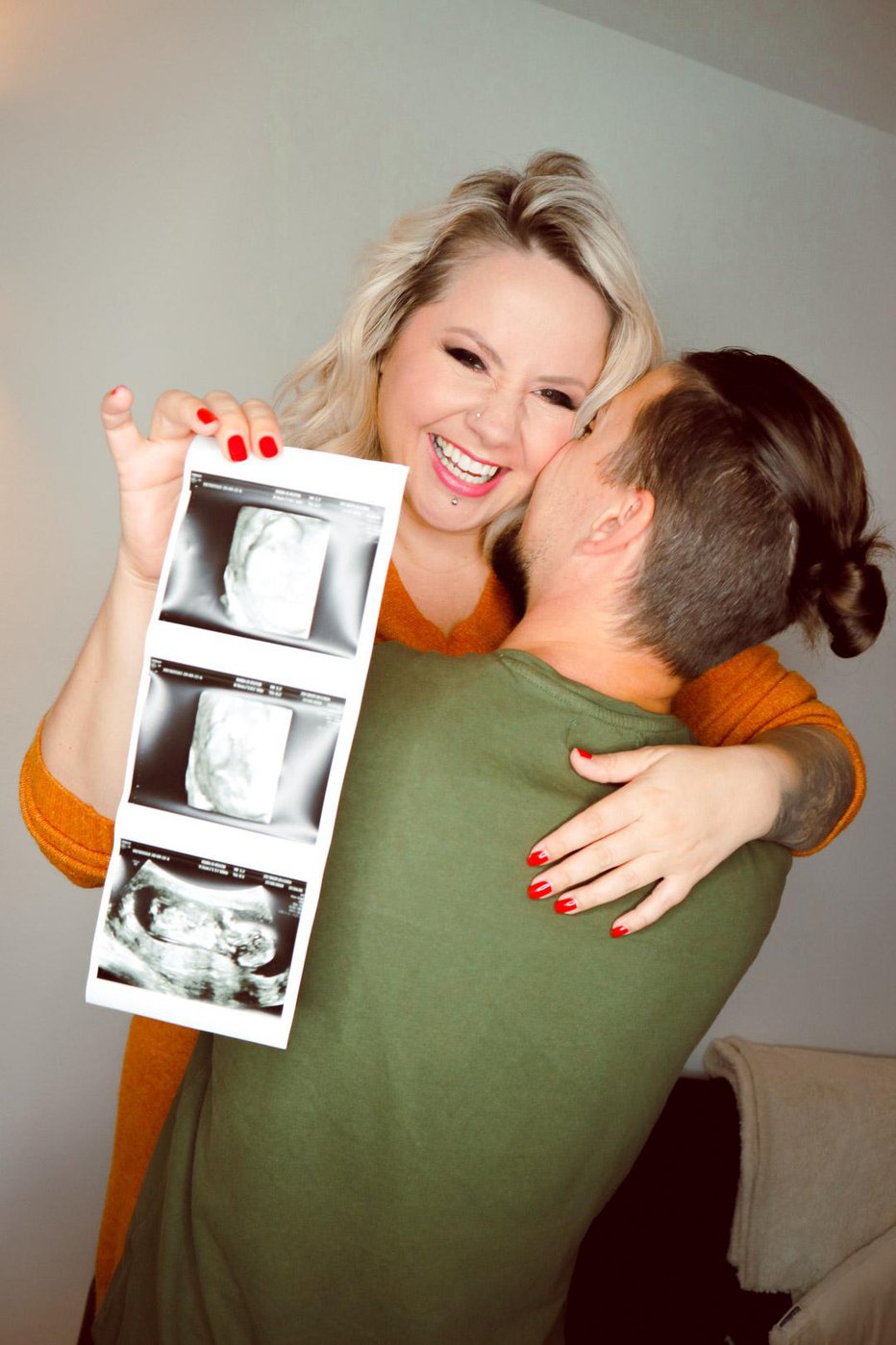 Fotografija: Nepopisna sreča, ko sta bodoča oče in mama zagledala prvo ultrazvočno sliko otroka. Foto Barvish