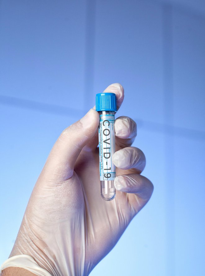 Če se bo imunost izgubljala, bo cepljenje proti covidu-19 vsakoletno kot proti gripi. FOTO: Juliano703/Getty Images
