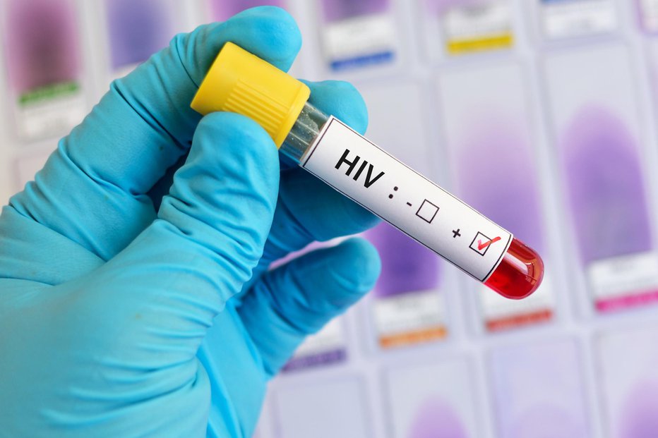 Fotografija: V Sloveniji je bilo letos do 20. novembra 28 okužb z virusom hiv. FOTO: Getty Images