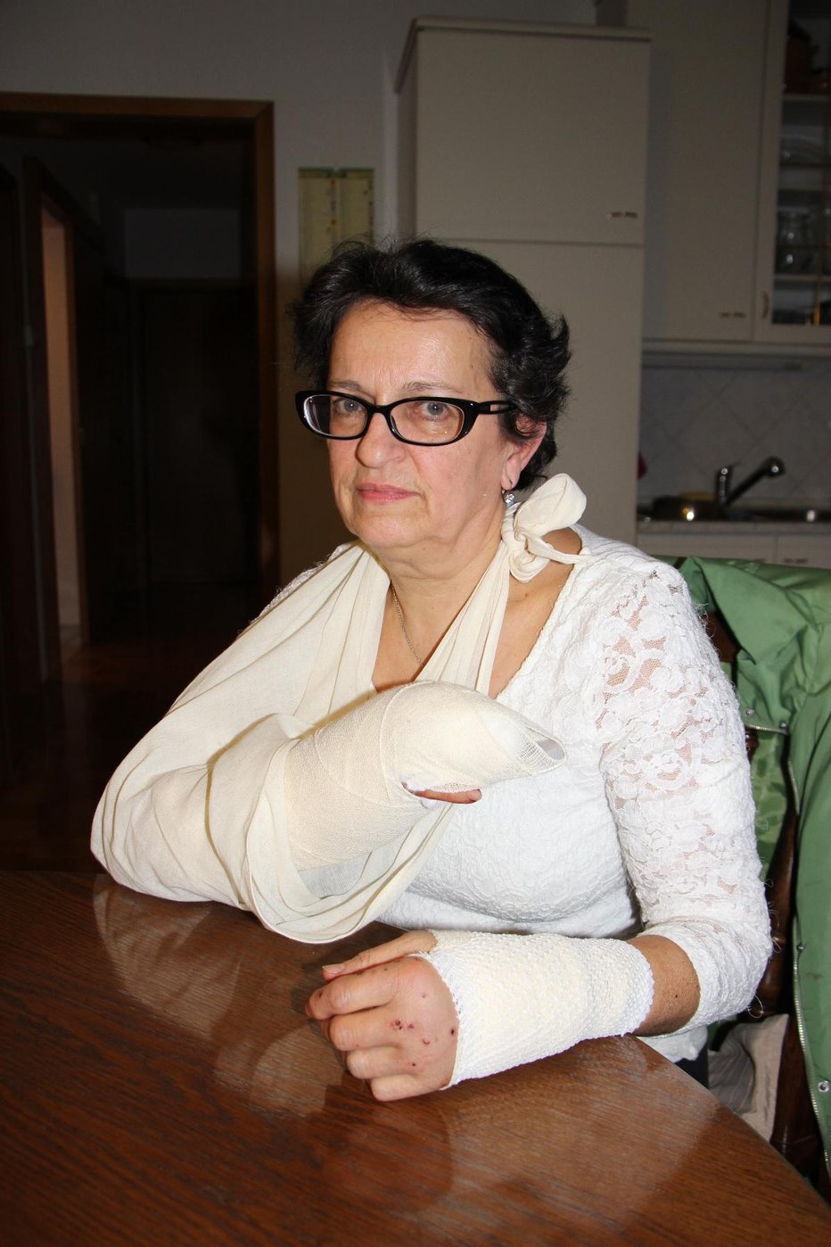 Fotografija: Magda Jazbec ima poškodovani obe roki, površinske rane pa tudi po stegnu FOTO: Tanja Jakše Gazvoda