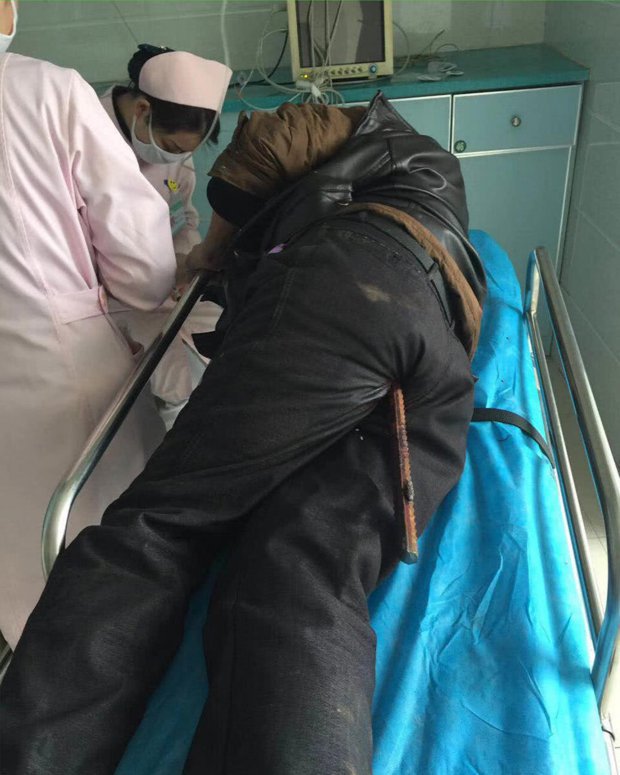 Fotografija: Nesrečnik na operacijski mizi. FOTO: twitter