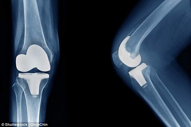 Primorca so zaradi težav z levim kolenom novembra 2011 operirali, a se je zapletlo. Foto: Shutterstock/arhiv dela