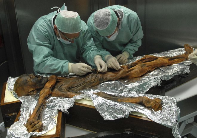 Ötzija je pokončala puščica. FOTO: AP
