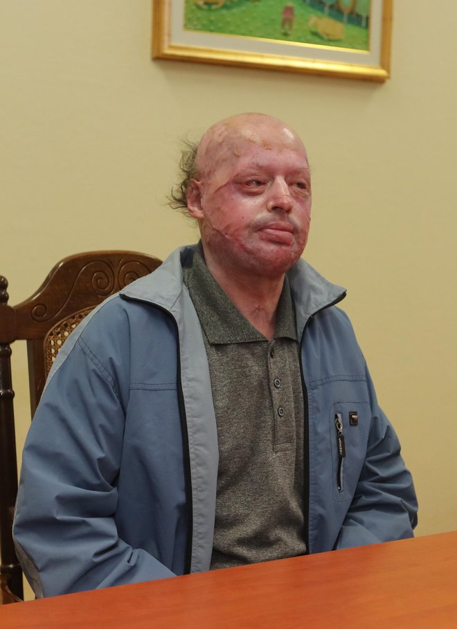 66-letni Ivan Mikec se ne spomni, zakaj je hotel zažgati spečo ženo. Foto: Dejan Javornik