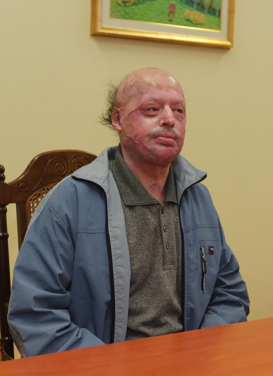 Fotografija: 66-letni Ivan Mikec se ne spomni, zakaj je hotel zažgati spečo ženo. Foto: Dejan Javornik