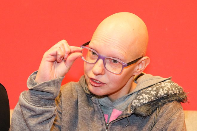 Suzana Žučko boleha za totalno alopecijo, kar pomeni, da je brez dlak po telesu. Brez las je od četrtega leta.