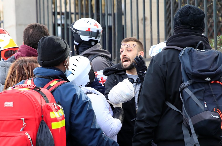 Fotografija: Poškodovani protestnik. FOTO: Gonzalo, Fuentes