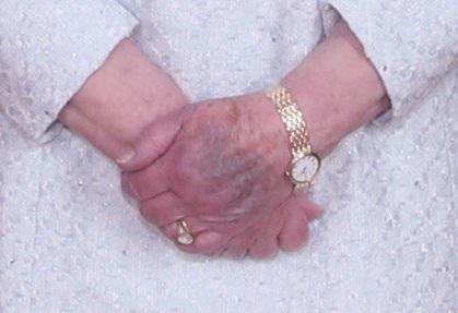 Modrica na levi roki kraljice Elizabete II. FOTO: Reuters