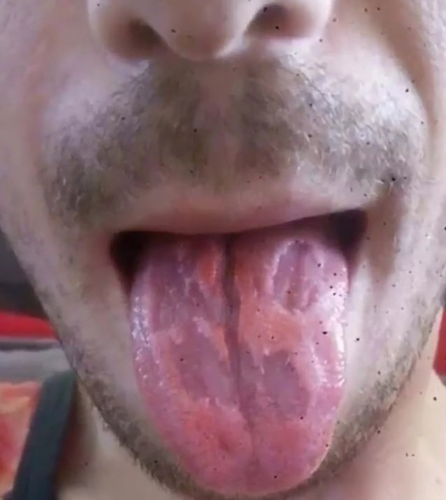 Fotografija: Pijača mu je razžrla jezik. FOTO: Zaslonski posnetek