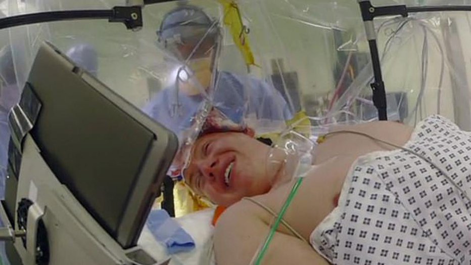 Fotografija: Cameron se je med operacijo šalil. FOTO: Facebook
