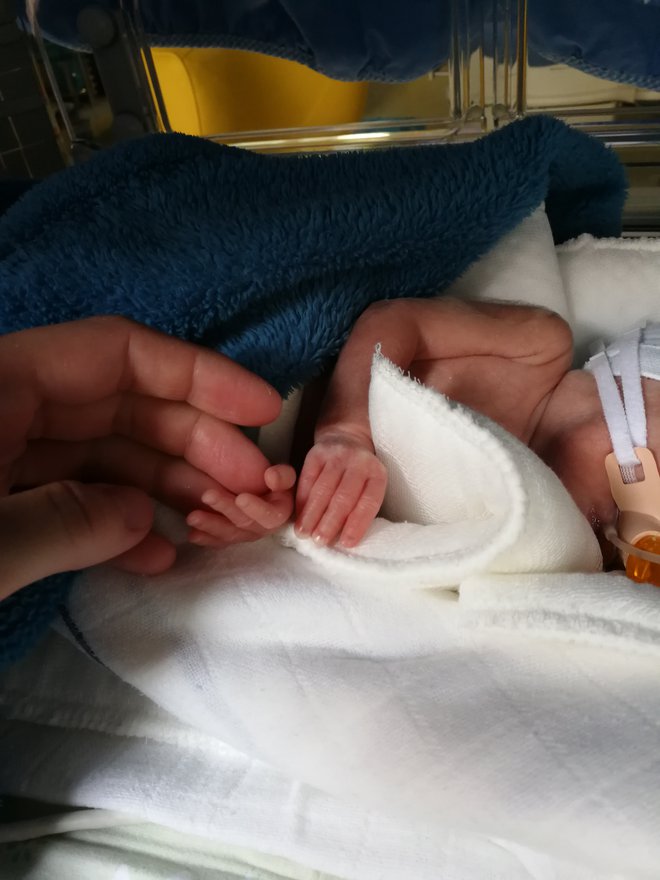 Alen je dolga dva meseca preživel v inkubatorju v ljubljanski porodnišnici. Rodil se je v 24. tednu, težak 650 gramov in velik 32 centimetrov. FOTO: osebni arhiv