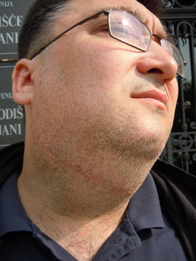 Zdaj že pokojnega taksista Tomaža Starino je Vid Lubi z olfa nožem porezal po vratu. FOTO: Arhiv