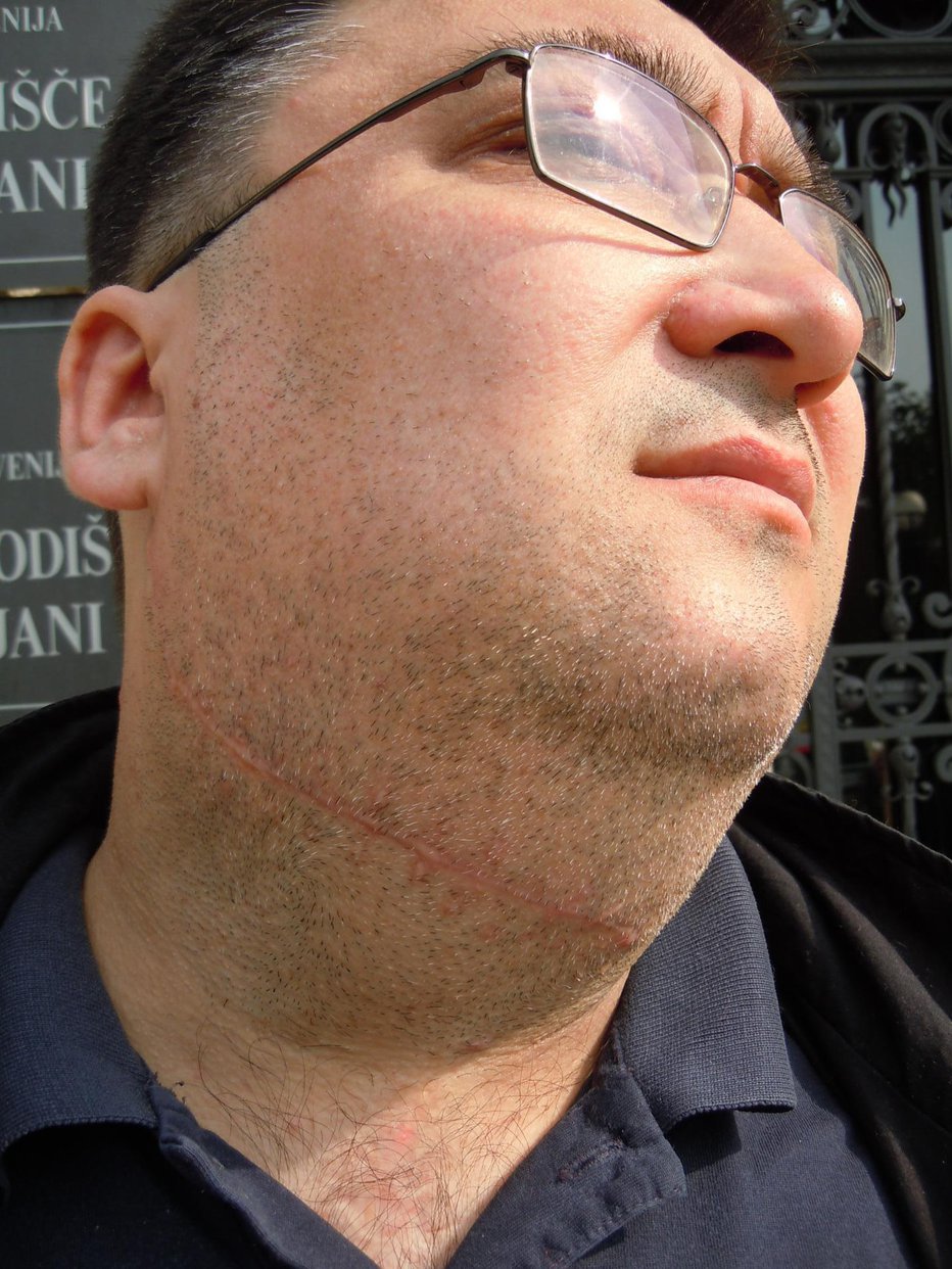 Fotografija: Zdaj že pokojnega taksista Tomaža Starino je Vid Lubi z olfa nožem porezal po vratu. FOTO: Arhiv