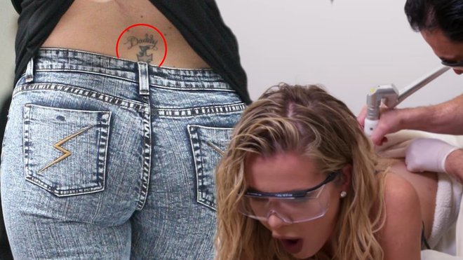Khloe Kardashian ve, kako boleče je lasersko odstranjevanje tetovaž.