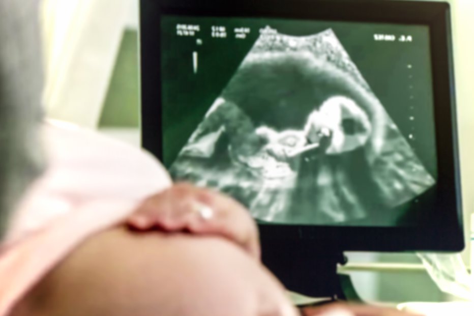 Fotografija: Zdravniki so v sedmem mesecu odkrili nosečega dojenčka. Fotografija je simbolična. FOTO: Shutterstock