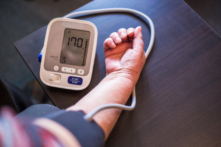 Fotografija: Krvni tlak je zvišan, če je sistolični enak ali višji kot 140 mmHg, diastolični pa enak ali višji kot 90 mmHg. FOTO: Guliver/Getty Images