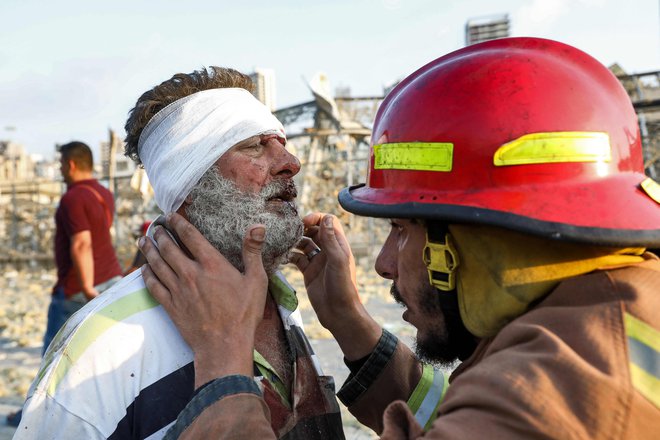 Libanonsko ministrstvo za zdravje je že sporočilo, da je bilo »ranjenih zelo, zelo veliko ljudi«. FOTO: Anwar Amro/AFP