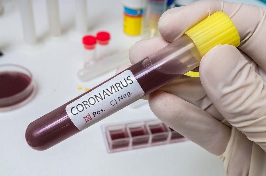 Fotografija: Po svetu se širi vse več različic novega koronavirusa. FOTO: Getty Images/istockphoto