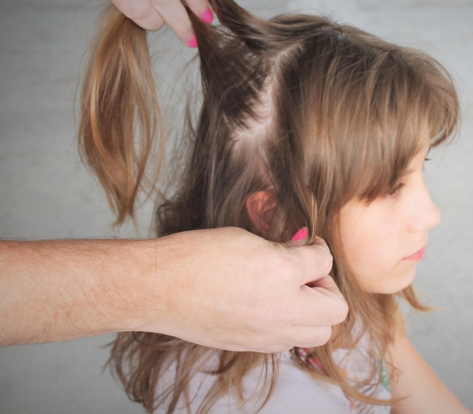 Fotografija: Otrokovo lasišče je modro preventivno pregledati enkrat tedensko, sploh med šolskim letom. FOTO: Getty Images/istockphoto
