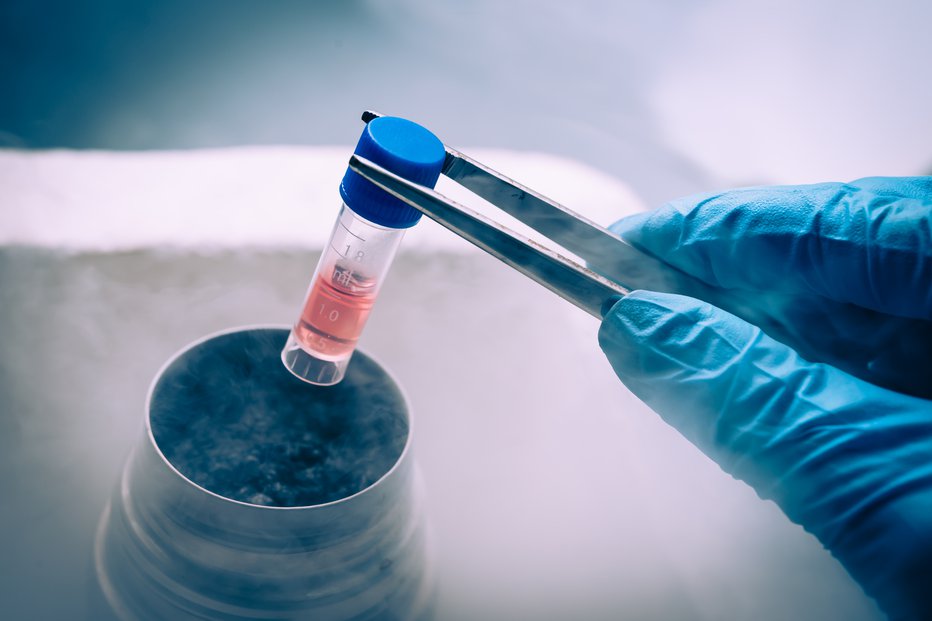 Fotografija: Zdravljenje z mezenhimskimi matičnimi celicami se je doselj izkazalo za uspešno. FOTO: Shutterstock.com
