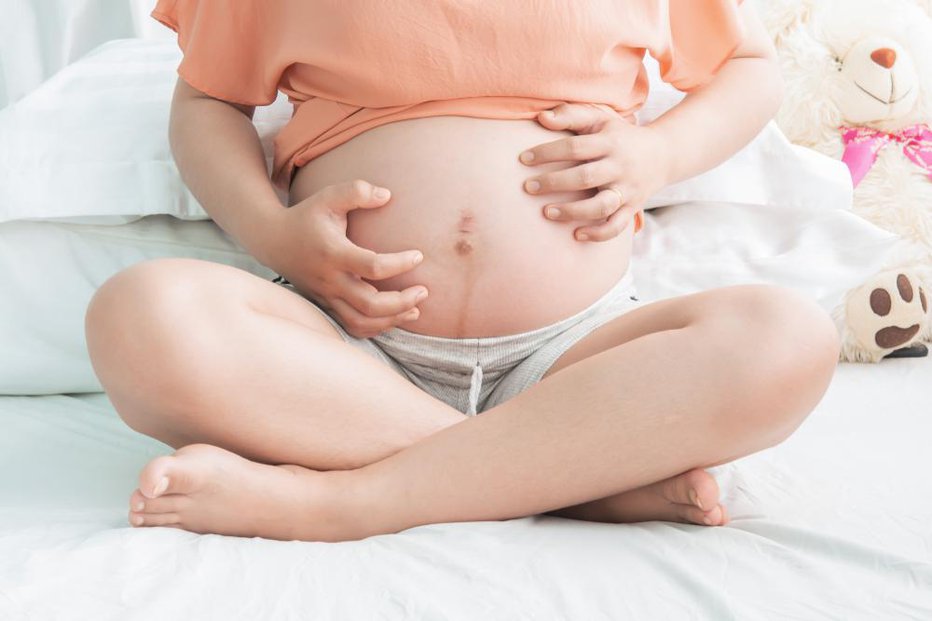 Fotografija: V nosečnosti se lahko pojavijo težave s kožo. FOTO: Srisakorn Wonglakorn, Shutterstock