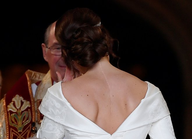 Princesa Eugenie je na poroki ponosno pokazala dolgo brazgotino.

FOTO: Toby Melville/Reuters
