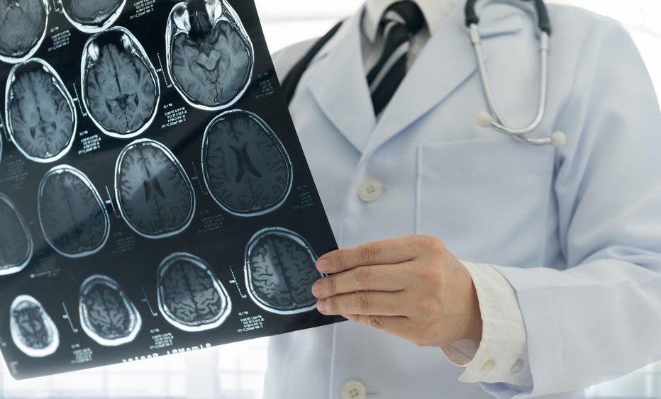 Fotografija: Primeri, ko se je komu s hudimi poškodbami možganov povrnil spomin, so redki. FOTO: Utah778/Getty Images
