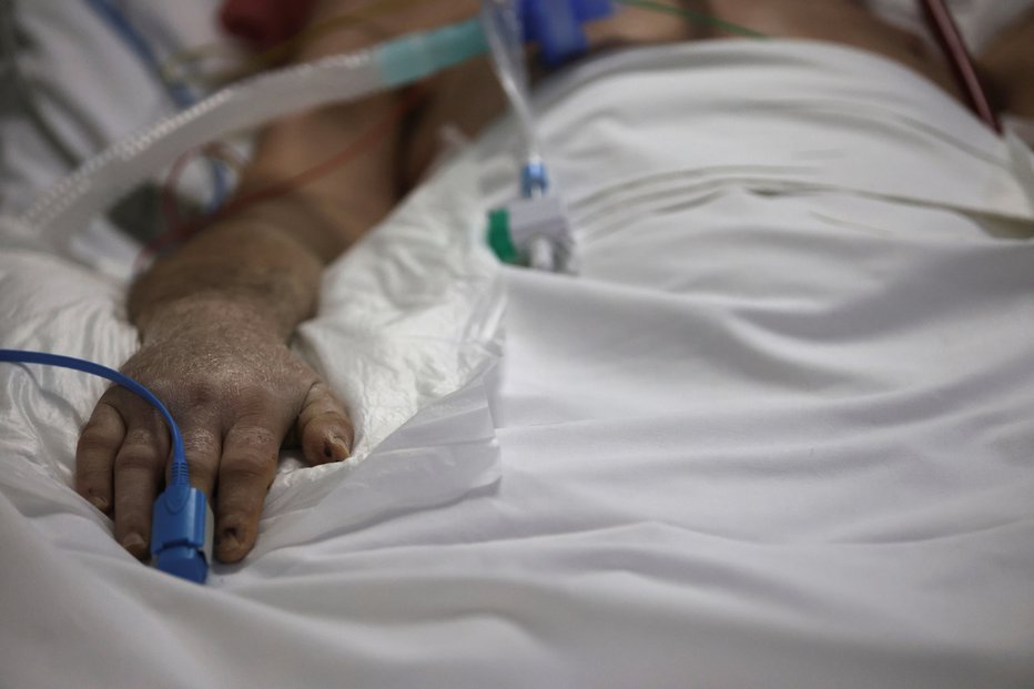 Fotografija: Stanje na intenzivnem oddelku covidnih bolnišnic je zelo zahtevno. FOTO: Giorgos Moutafis, Reuters
