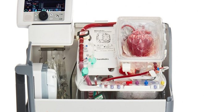 S takšno napravo bi v Sloveniji lahko transplantirali tri dodatna srca vsako leto.
