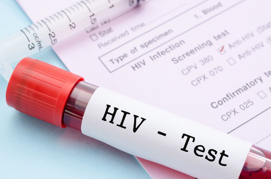 Fotografija: Ne odlašajte s testiranjem na virus hiv. FOTO: Shutterstock
