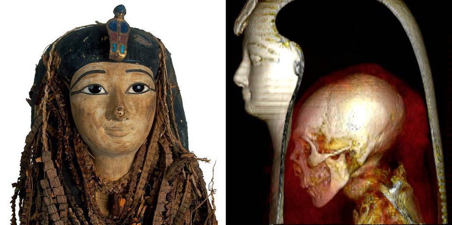 Fotografija: Posmrtna maska in lobanja faraona Amenhotepa I. FOTO: Egiptovsko ministrstvo za starine
