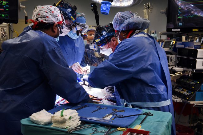 Kirurg Bartley P. Griffith med operacijo. FOTO: Umsom, Via Reuters
