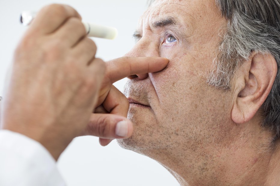 Fotografija: Katarakta je zamotnitev očesne leče. FOTO: Seb_ra/Getty Images
