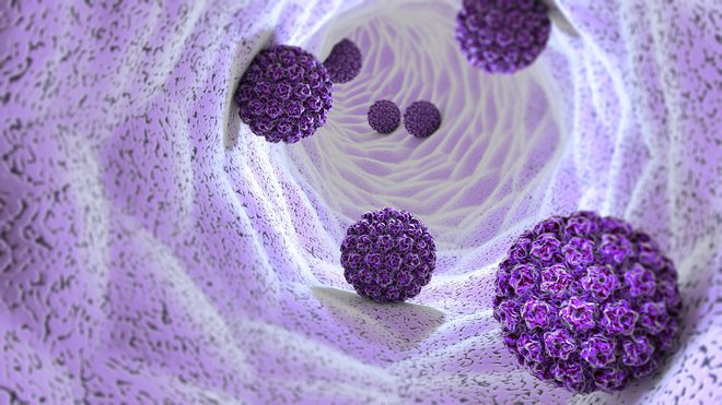 Okužba s HPV je najpogostejša spolno prenosljiva okužba na svetu. FOTO: Naeblys/Getty Images
