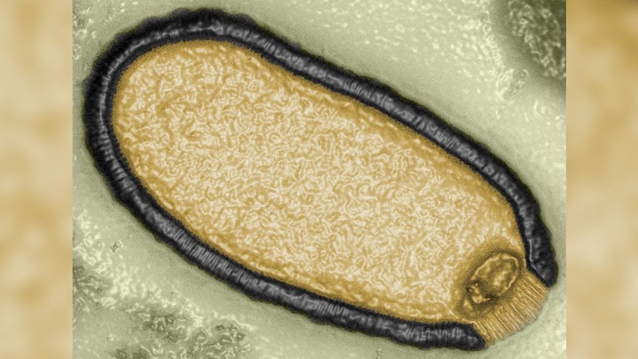 Fotografija: Znanstveniku je uspelo oživiti virus, ki ga je s svojo ekipo izoliral iz permafrosta. Na fotografiji je računalniško izboljšana mikrofotografija Pithovirus sibericum, ki je bila leta 2014 izolirana iz 30.000 let starega vzorca permafrosta. FOTO: Jean-michel Claverie/igs/cnrs-am
